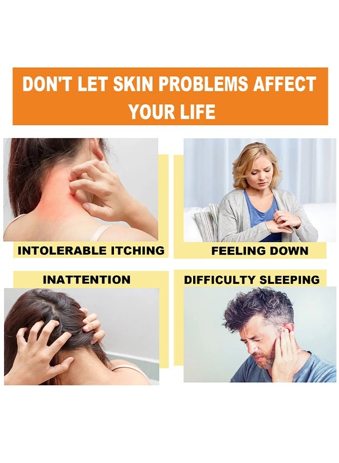 South Moon - Bee Venom Psoriasis Care Cream