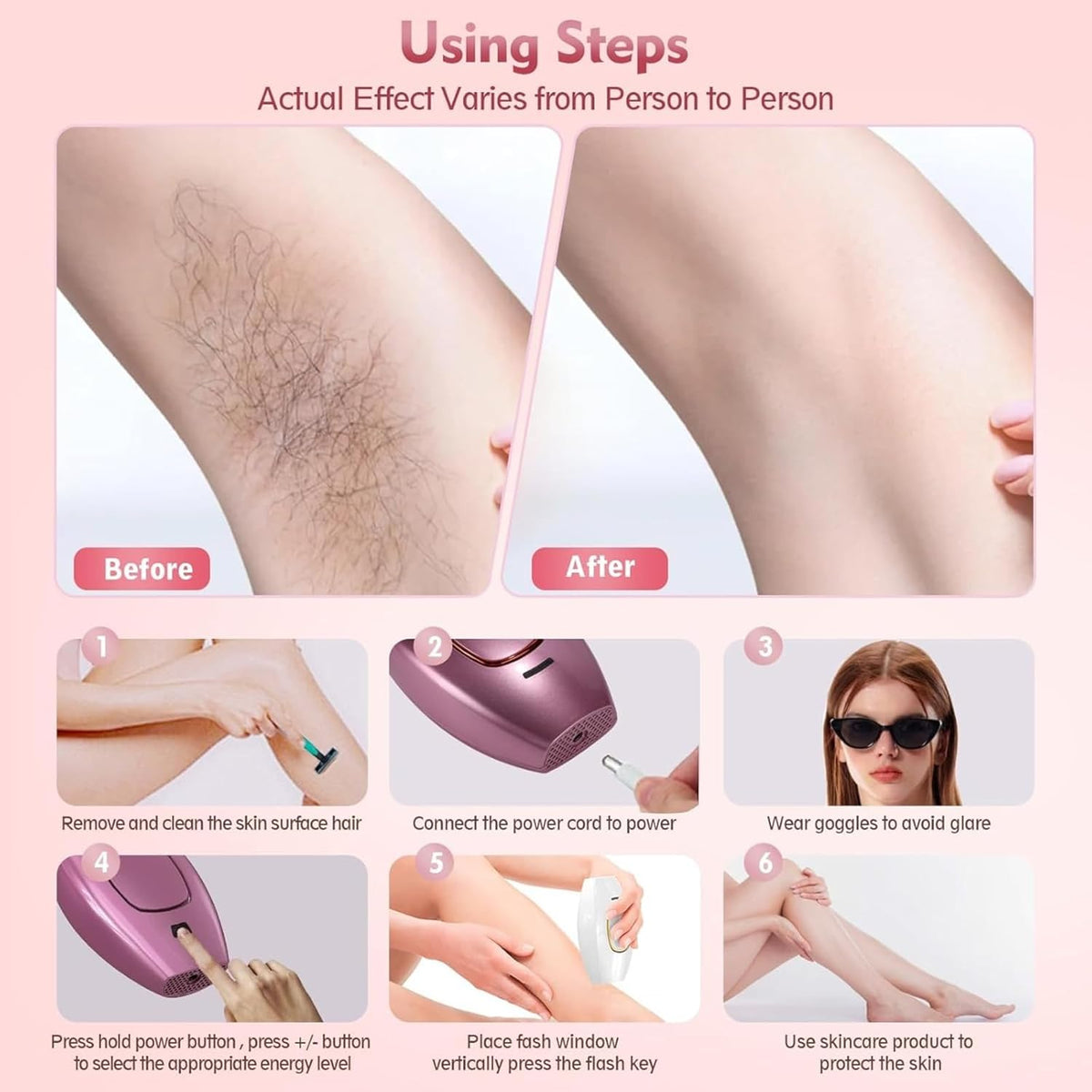 Mini Laser Hair Removal