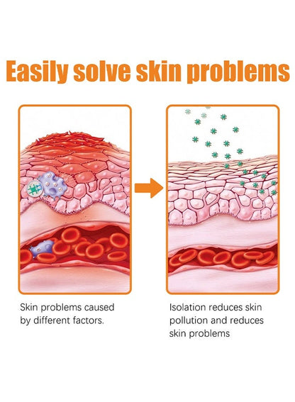 South Moon - Bee Venom Psoriasis Care Cream