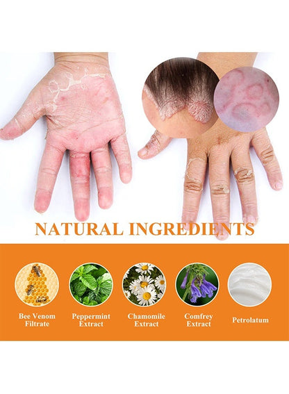 South Moon - Bee Venom Psoriasis Care Cream